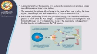 • A computer analyzes those gamma rays and uses the information to create an image
map of the organ or tissue being studied.
• The amount of the radionuclide collected in the tissue affects how brightly the tissue
appears on the image, and indicates the level of organ or tissue function.
• For example, the healthy tissues uses glucose for energy, it accumulates some of the
glucose to show up on the PET images. The cancerous tissues uses more glucose than
the normal tissues. So, it will accumulate more of the glucose and will appear more
brighter than the normal tissues on the PET images.
 
