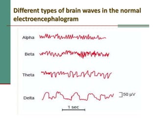 Different types of brain waves in the normal
electroencephalogram
 