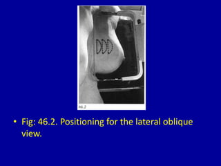 • Fig: 46.2. Positioning for the lateral oblique
view.
 