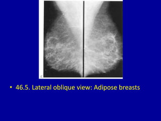• 46.5. Lateral oblique view: Adipose breasts
 