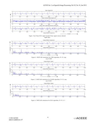 Simulation of Adaptive Noise Canceller for an ECG signal Analysis | PDF