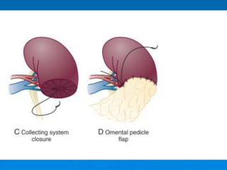CHẤN THƯƠNG VÀ VẾT THƯƠNG THẬN