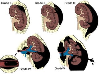 CHẤN THƯƠNG VÀ VẾT THƯƠNG THẬN