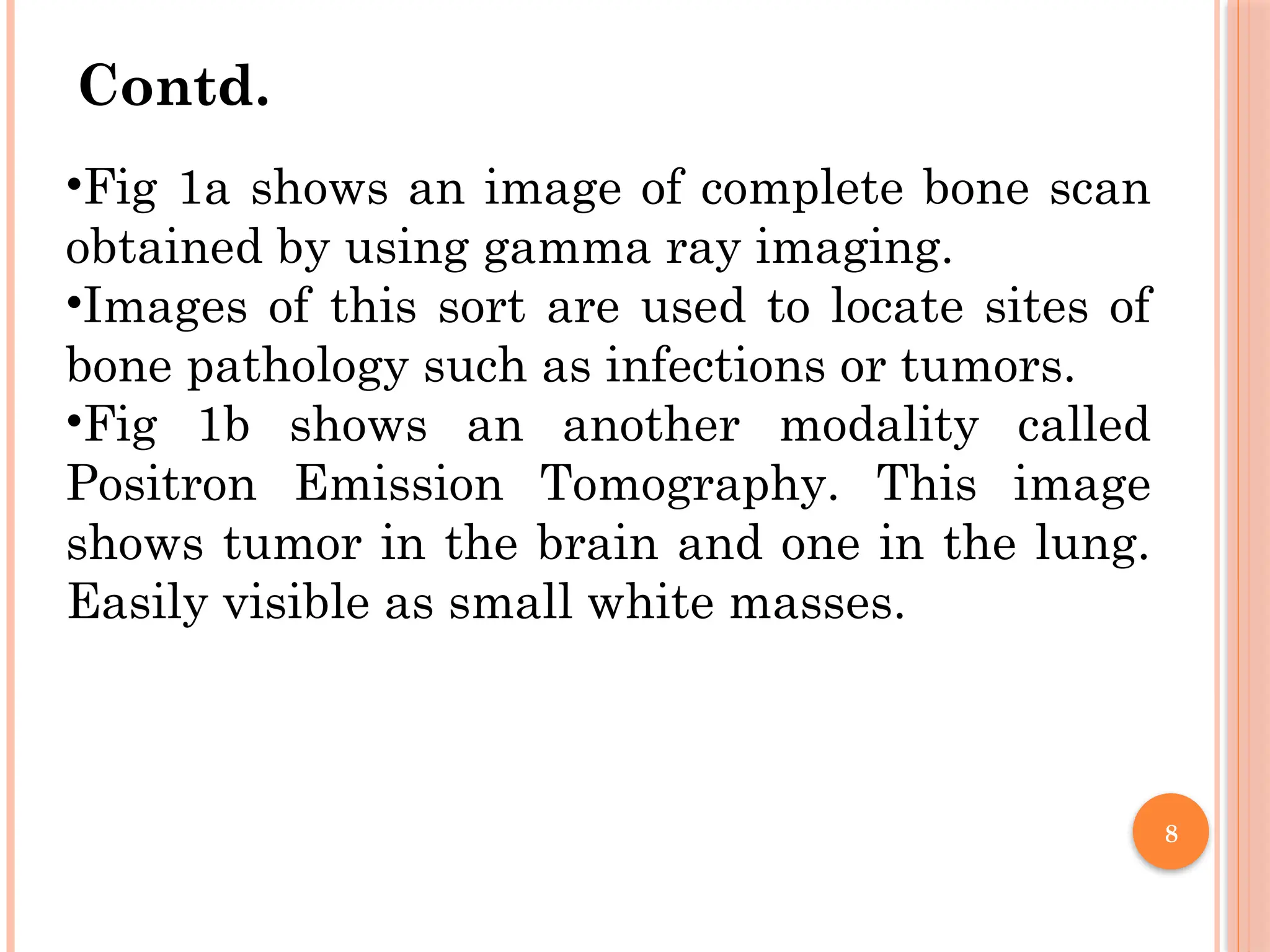 8
Contd.
•Fig 1a shows an image of complete bone scan
obtained by using gamma ray imaging.
•Images of this sort are used to locate sites of
bone pathology such as infections or tumors.
•Fig 1b shows an another modality called
Positron Emission Tomography. This image
shows tumor in the brain and one in the lung.
Easily visible as small white masses.
 