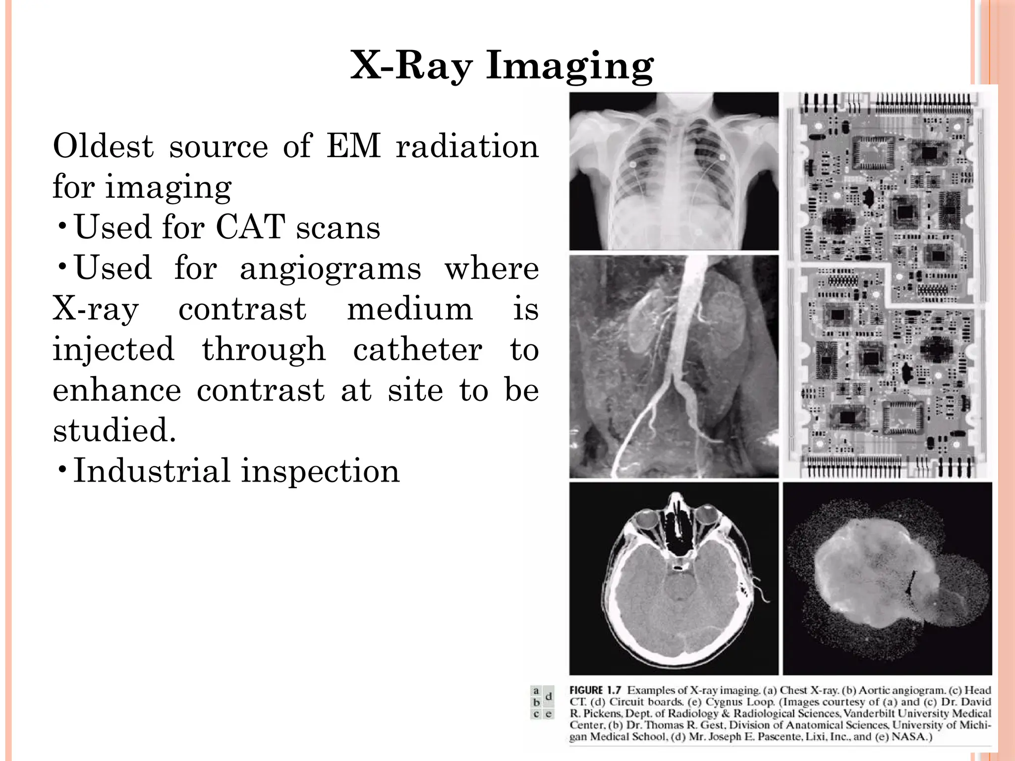 9
X-Ray Imaging
Oldest source of EM radiation
for imaging
•Used for CAT scans
•Used for angiograms where
X-ray contrast medium is
injected through catheter to
enhance contrast at site to be
studied.
•Industrial inspection
 