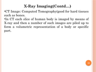 10
•CT Image: Computed Tomography(good for hard tissues
such as bones.
•In CT each slice of human body is imaged by means of
X-ray and then a number of such images are piled up to
form a volumetric representation of a body or specific
part.
X-Ray Imaging(Contd…)
 