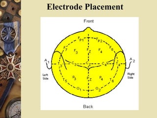Electrode Placement
 