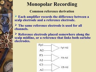 Monopolar Recording
Common reference derivation
 Each amplifier records the difference between a
scalp electrode and a reference electrode.
 The same reference electrode is used for all
channels.
 Reference electrode placed somewhere along the
scalp midline, or a reference that links both earlobe
electrodes.
 
