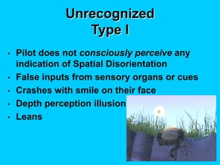 Unrecognized
Type I
• Pilot does not consciously perceive any
indication of Spatial Disorientation
• False inputs from sensory organs or cues
• Crashes with smile on their face
• Depth perception illusion
• Leans
 