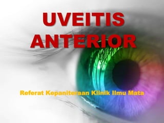 UVEITIS
   ANTERIOR

Referat Kepaniteraan Klinik Ilmu Mata
 