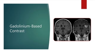 Gadolinium-Based
Contrast
 