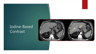 Iodine-Based
Contrast
 