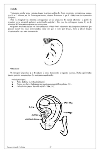 Humaniversidade Holística 22 
Método 
Tratamento similar ao do vício de drogas. Inserir as agulhas 2 a 3 mm nos pontos normalmente usados, por 10 a 15 minutos, de 3 a 5 vezes por semana, durante 3 semanas, o que é válido como um tratamento completo. 
Para os desagradáveis sintomas consequentes ao uso excessivo do álcool, adicionar o ponto do principal nervo occipital (próximo ao tubérculo auricular). Em caso de embriaguez, injetar 0,5 cc de vitamina B12 nos pontos usualmente empregados. 
Os pontos auxiliares devem ser selecionados de acordo com o tratamento dos complexos sintomas que possam surgir nos casos mencionados, uma vez que o vício por drogas, fumo e álcool trazem consequências para todo o organismo. 
Obesidade 
O princípio terapêutico é o de reduzir a fome, diminuindo a ingestão calórica. Dietas apropriadas devem também ser prescritas. Os pontos empregados são: 
Pontos principais: 
☯ 
Ponto da fome (52) (bilateralmente) 
☯ 
Pontos auxiliares: lado esquerdo: ponto estômago (62) e pulmão (82), 
☯ 
Lado direito: ponto Shen-Men (107), SNV (88)  