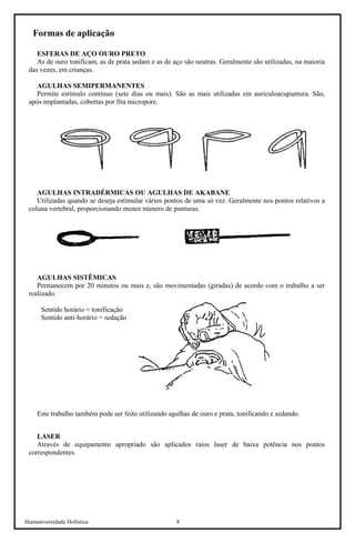 Humaniversidade Holística 8 
Formas de aplicação 
ESFERAS DE AÇO OURO PRETO 
As de ouro tonificam, as de prata sedam e as de aço são neutras. Geralmente são utilizadas, na maioria das vezes, em crianças. 
AGULHAS SEMIPERMANENTES 
Permite estímulo contínuo (sete dias ou mais). São as mais utilizadas em auriculoacupuntura. São, após implantadas, cobertas por fita micropore. 
AGULHAS INTRADÉRMICAS OU AGULHAS DE AKABANE 
Utilizadas quando se deseja estimular vários pontos de uma só vez. Geralmente nos pontos relativos a coluna vertebral, proporcionando menor número de punturas. 
AGULHAS SISTÊMICAS 
Permanecem por 20 minutos ou mais e, são movimentadas (giradas) de acordo com o trabalho a ser realizado. 
Sentido horário = tonificação 
Sentido anti-horário = sedação 
Este trabalho também pode ser feito utilizando agulhas de ouro e prata, tonificando e sedando. 
LASER 
Através de equipamento apropriado são aplicados raios laser de baixa potência nos pontos correspondentes.  