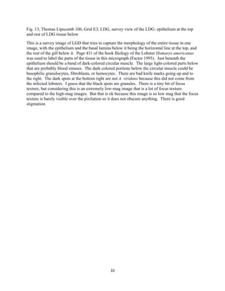 Fig. 13, Thomas Lipscomb 106, Grid E3, LDG, survey view of the LDG: epithelium at the top
and rest of LDG tissue below
This is a survey image of LGD that tries to capture the morphology of the entire tissue in one
image, with the epithelium and the basal lamina below it being the horizontal line at the top, and
the rest of the gill below it. Page 411 of the book Biology of the Lobster Homarys americanus
was used to label the parts of the tissue in this micrograph (Factor 1995). Just beneath the
epithelium should be a band of dark-colored circular muscle. The large light-colored parts below
that are probably blood sinuses. The dark colored portions below the circular muscle could be
basophilic granulocytes, fibroblasts, or hemocytes. There are bad knife marks going up and to
the right. The dark spots at the bottom right are not A. viridans because this did not come from
the infected lobsters. I guess that the black spots are granules. There is a tiny bit of focus
texture, but considering this is an extremely low-mag image that is a lot of focus texture
compared to the high-mag images. But that is ok because this image is so low mag that the focus
texture is barely visible over the pixilation so it does not obscure anything. There is good
stigmation.
33
 