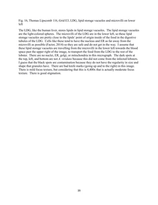 Fig. 16, Thomas Lipscomb 116, Grid E3, LDG, lipid storage vacuoles and microvilli on lower
left
The LDG, like the human liver, stores lipids in lipid storage vacuoles. The lipid storage vacuoles
are the light-colored spheres. The microvilli of the LDG are in the lower left, so these lipid
storage vacuoles are pretty close to the lipids’ point of origin inside of the food in the digestive
tubules of the LDG. Cells like these tend to have the nucleus and ER as far away from the
microvilli as possible (Factor, 2014) so they are safe and do not get in the way. I assume that
these lipid storage vacuoles are travelling from the microvilli in the lower left towards the blood
space past the upper right of the image, to transport the food from the LDG to the rest of the
lobster. There are no nuclei, ER, golgi, or mitochondria in this micrograph. The dark spots at
the top, left, and bottom are not A. viridans because this did not come from the infected lobsters.
I guess that the black spots are contamination because they do not have the regularity in size and
shape that granules have. There are bad knife marks (going up and to the right) in this image.
There is mild focus texture, but considering that this is 4,400x that is actually moderate focus
texture. There is good stigmation.
39
 