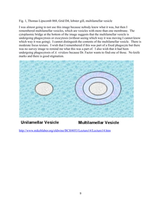 Fig. 1, Thomas Lipscomb 068, Grid D4, lobster gill, multilamellar vesicle
I was almost going to not use this image because nobody knew what it was, but then I
remembered multilamellar vesicles, which are vesicles with more than one membrane. The
cytoplasmic bridge at the bottom of the image suggests that the multilamellar vesicle is
undergoing phagocytosis or exocytosis (without seeing which way it was moving I cannot know
which way it was going). I cannot distinguish the contents of the multilamellar vesicle. There is
moderate focus texture. I wish that I remembered if this was part of a fixed phagocyte but there
was no survey image to remind me what this was a part of. I also wish that it had been
undergoing phagocytosis of A. viridans because Dr. Factor wants to find one of those. No knife
marks and there is good stigmation.
http://www.mikeblaber.org/oldwine/BCH4053/Lecture14/Lecture14.htm
9
 