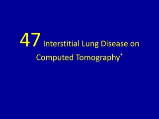 47Interstitial Lung Disease on
Computed Tomography*
 