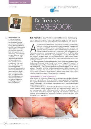 48 
S K I N/ D E RMATOLOGY 
Aesthetic Medicine • November 2014 
SPONSORED BY 
Dr Patrick Treacy shares some of his most challenging 
cases. This month he talks about treating basal cell cancer 
Dr Treacy’s 
CASEBOOK 
DR PATRICK TREACY 
is chairman of the Irish 
Association of Cosmetic 
Doctors and Irish regional 
representative of the British 
College of Aesthetic Medicine 
(BCAM). He is European medical 
advisor to Network Lipolysis 
and Consulting Rooms and 
holds higher qualifications in 
dermatology, laser technology 
and skin resurfacing. In 2012 
and 2013 he won awards for 
‘Best Innovative Techniques’ 
for his contributions to 
facial aesthetics and hair 
transplants. Dr Treacy also 
sits on the editorial boards 
of three international 
journals and features regularly 
on international television and 
radio programmes. He was a 
faculty member at IMCAS 
Paris 2013, AMWC Monaco 
2013, EAMWC Moscow 2013 
and a keynote speaker for 
the American Academy of 
Anti-Ageing Medicine in 
Mexico City this year. 
>> 
A 43-year-old Irish male patient was referred to Ailesbury with a slowly 
enlarging lesion on the right side of his neck that wouldn’t heal and bled 
when traumatised. The patient described it as an acne lump that had 
appeared about a year before and he felt in the beginning that he could 
express some pus or fluid from it from time to time. More recently he 
had become concerned because a course of antibiotics from his GP had failed 
to make any impact on the lesion. The patient gave a history of occupational 
sun exposure as he worked in the construction industry. There was no relevant 
medical history and the patient did not have any clinical evidence of autoimmune 
or allergic diseases. 
On examination the lesion appeared eroded and ulcerated and bled easily when 
traumatised. There was some crusting at the anterior margins. The presence of 
rolled borders, pearly edges and telangiectases gave a clinical suspicion of basal 
cell carcinoma (BCC) and a decision was made to proceed to removal rather than do 
a biopsy. The author feels that any doctor should consider BCC in any patient with 
a history of a sore or skin anomaly that does not heal within four to six weeks and 
occurs on sun-exposed skin, especially if it is dimpled in the middle. These tumors 
may take many months or years to reach even 1cm in diameter. 
TREATMENT (EXCISIONAL SURGERY) 
After numbing the area with local anesthesia, an 11 scalpel to remove the entire growth 
along with a surrounding border of normal skin as a safety margin. The skin around 
the surgical site is then closed with a number of stitches, and the excised tissue is 
sent to the laboratory for microscopic examination to verify that all the malignant 
cells have been removed. 
People who sunburn are more likely to develop skin cancer than those who 
do not; however, sunlight damages the skin with or without sunburn. History of 
any prior treatment to the index tumor should be elicited, as well as history of 
any prior non-melanoma skin cancer. In patients with recurrent tumors, deeper 
invasion should be expected. Recurrence following radiation therapy is often 
biologically more aggressive. 
CASE FILES www.aestheticmed.co.uk 
ABOVE AND OPPOSITE PAGE: Resection of basal cell carcinoma from neck area of patient with deep sutures and primary closure 
 