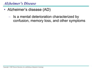 Alzheimer’s Disease Alzheimer’s disease (AD) Is a mental deterioration characterized by confusion, memory loss, and other symptoms 