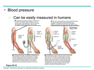 Copyright © 2005 Pearson Education, Inc. publishing as Benjamin Cummings
• Blood pressure
– Can be easily measured in humans
Figure 42.12
Artery
Rubber cuff
inflated
with air
Artery
closed
120 120
Pressure
in cuff
above 120
Pressure
in cuff
below 120
Pressure
in cuff
below 70
Sounds
audible in
stethoscope
Sounds
stop
Blood pressure
reading: 120/70
A typical blood pressure reading for a 20-year-old
is 120/70. The units for these numbers are mm of
mercury (Hg); a blood pressure of 120 is a force that
can support a column of mercury 120 mm high.
1
A sphygmomanometer, an inflatable cuff attached to a
pressure gauge, measures blood pressure in an artery.
The cuff is wrapped around the upper arm and inflated
until the pressure closes the artery, so that no blood
flows past the cuff. When this occurs, the pressure
exerted by the cuff exceeds the pressure in the artery.
2 A stethoscope is used to listen for sounds of blood flow
below the cuff. If the artery is closed, there is no pulse
below the cuff. The cuff is gradually deflated until blood
begins to flow into the forearm, and sounds from blood
pulsing into the artery below the cuff can be heard with
the stethoscope. This occurs when the blood pressure
is greater than the pressure exerted by the cuff. The
pressure at this point is the systolic pressure.
3
The cuff is loosened further until the blood flows freely
through the artery and the sounds below the cuff
disappear. The pressure at this point is the diastolic
pressure remaining in the artery when the heart is relaxed.
4
70
 