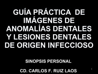 GUÍA PRÁCTICA DE
    IMÁGENES DE
ANOMALÍAS DENTALES
Y LESIONES DENTALES
DE ORIGEN INFECCIOSO

     SINOPSIS PERSONAL
                             1
   CD. CARLOS F. RUIZ LAOS
 
