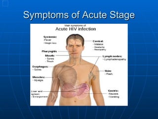 Symptoms of Acute Stage 