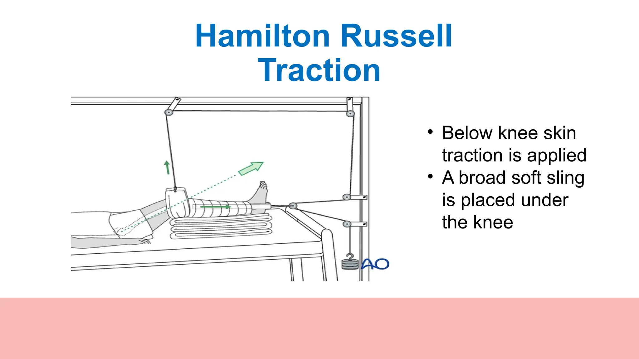485262999-bengtraction in nursingas.pptx