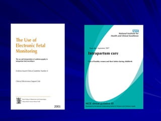 Issue date: September 2007
NICE clinical guideline 55
Developed by the National Collaborating Centre for Women’s and Children’s Health
Intrapartum care
Care of healthy women and their babies during childbirth
2001
 