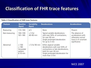 Classification of FHR trace features
NICE 2007
 