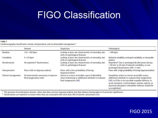 FIGO Classification
FIGO 2015
 