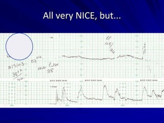 All very NICE, but...
 