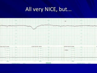 All very NICE, but...
 