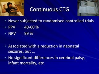 Continuous CTG
• Never subjected to randomised controlled trials
• PPV 40-60 %
• NPV 99 %
• Associated with a reduction in neonatal
seizures, but …
• No significant differences in cerebral palsy,
infant mortality, etc
 
