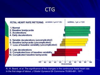 CTG
R. W. Beard, et al. The significance of the changes in the continuous foetal heart rate
in the first stage of labour. J Obstet Gynaecol Br Commonw 78:865-881, 1971.
 