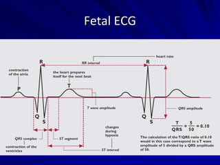 Fetal ECG
 