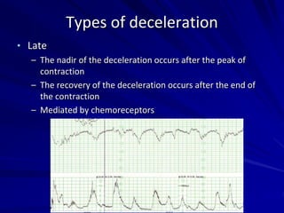 Types of deceleration
• Late
– The nadir of the deceleration occurs after the peak of
contraction
– The recovery of the deceleration occurs after the end of
the contraction
– Mediated by chemoreceptors
 