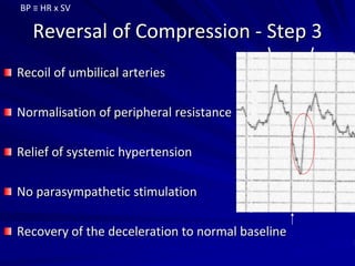 Reversal of Compression - Step 3
Recoil of umbilical arteries
Normalisation of peripheral resistance
Relief of systemic hypertension
No parasympathetic stimulation
Recovery of the deceleration to normal baseline
BP ≡ HR x SV
 