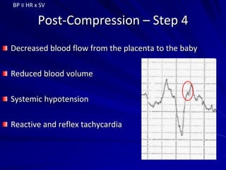 Post-Compression – Step 4
Decreased blood flow from the placenta to the baby
Reduced blood volume
Systemic hypotension
Reactive and reflex tachycardia
BP ≡ HR x SV
 