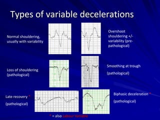 Types of variable decelerations
Normal shouldering,
usually with variability
Loss of shouldering
(pathological)
Late recovery *
(pathological)
Overshoot
shouldering +/-
variability (pre-
pathological)
Smoothing at trough
(pathological)
Biphasic deceleration *
(pathological)
* = also Labour Variable
 