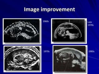 Image improvement
1980s1970s
Late
1970s
1960s
 