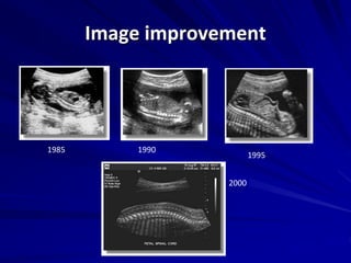 Image improvement
1985
2000
1990
1995
 