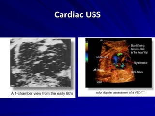 Cardiac USS
 
