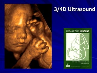 3/4D Ultrasound
 