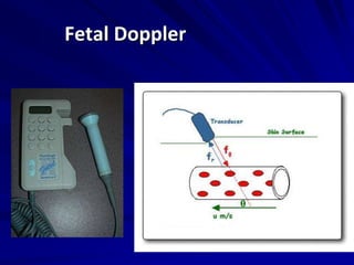 Fetal Doppler
 