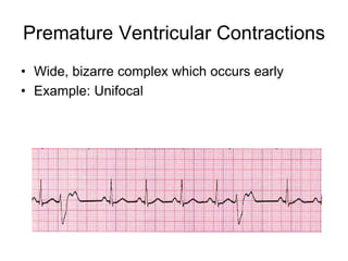 basic principles of cardiovasctular system | PPT