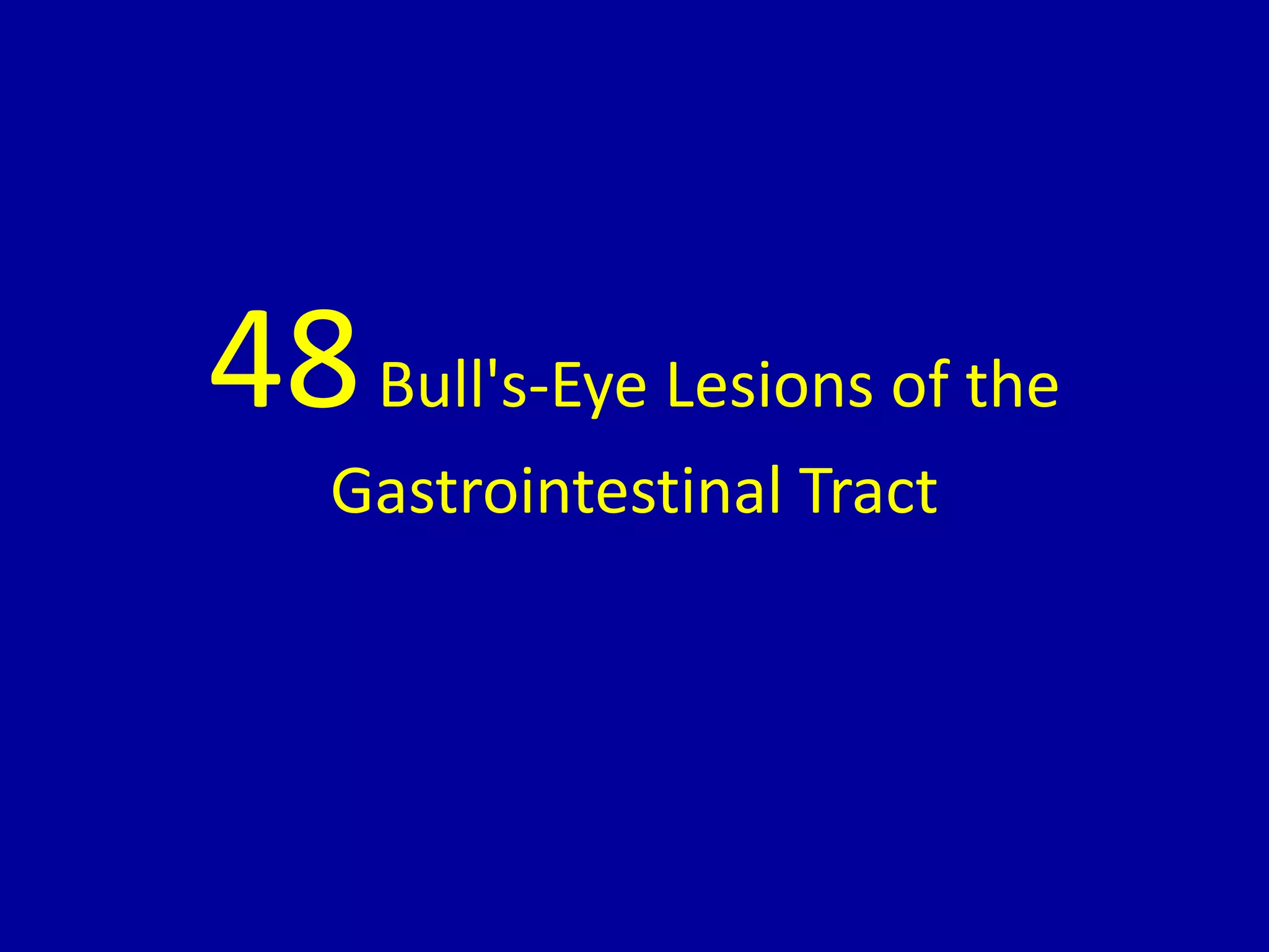 48 bull's eye lesions of the gastrointestinal tract PPT