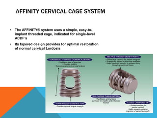 AFFINITY CERVICAL CAGE SYSTEM
• The AFFINITY® system uses a simple, easy-to-
implant threaded cage, indicated for single-level
ACDF’s
• Its tapered design provides for optimal restoration
of normal cervical Lordosis
 