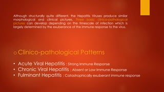 Although structurally quite different, the Hepatitis Viruses produce similar
morphological and clinical pictures. Three basic clinico-pathological
pictures can develop depending on the timescale of infection which is
largely determined by the exuberance of the immune response to the virus.
oClinico-pathological Patterns
• Acute Viral Hepatitis : Strong Immune Response
• Chronic Viral Hepatitis : Absent or Low Immune Response
• Fulminant Hepatitis : Catastrophically exuberant immune response
 