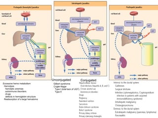Unconjugated                   Conjugated
Excessive heme metabolism            Gilbert syndrome
 Hemolysis                           Crigler-Najjar
  hemolytic anemias                   Type I (total lack of UGT)
  autoinmune disorders                Type II
  drugs
  defects in hemoglobin structure
 Reabsorption of a large hematoma
 